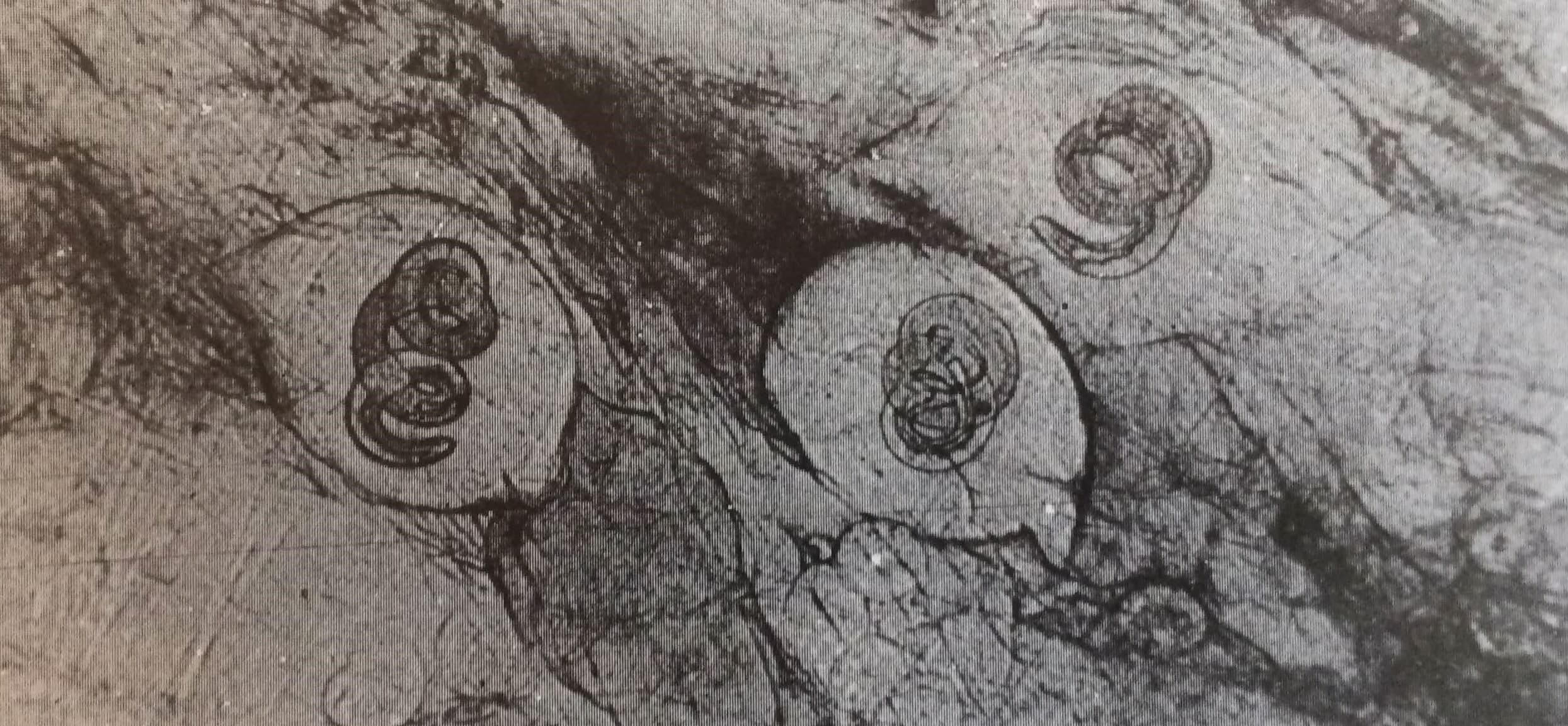 A trichinellózisról (Nimród, 1980. június)